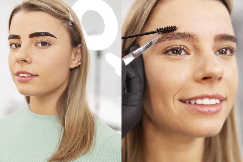 remoção de micropigmentação sobrancelha